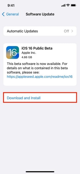 click on the download and install button